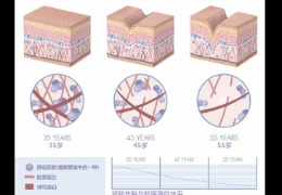 都在問(wèn)的乙酰殼糖胺（NAG）功效怎么樣？功效成分的護膚品應該怎么選？